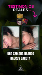 Daucus Carota K10 – limpieza desde la raíz de los granos e infecciones d ella piel luce luminosa sin excusas e hidratad@