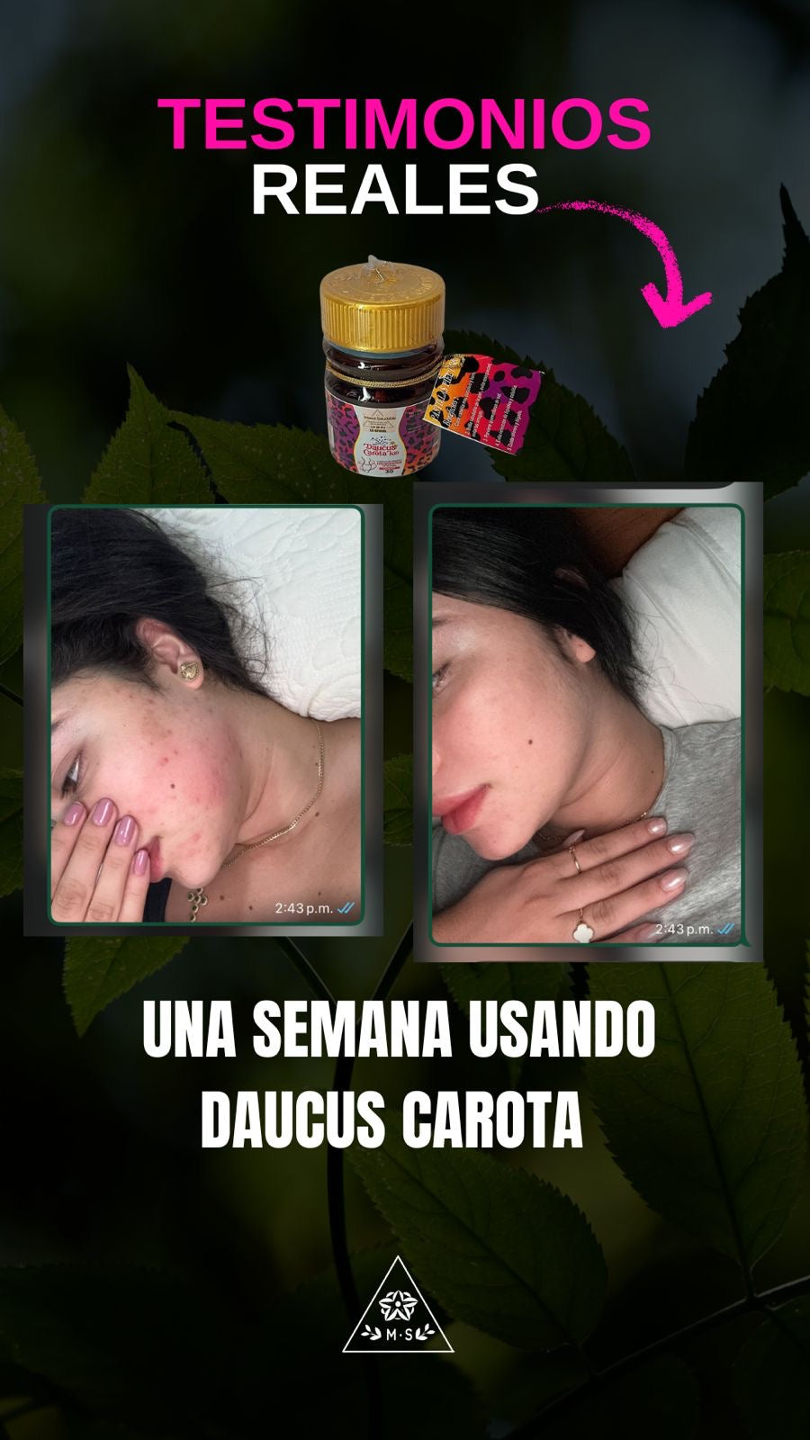 Daucus Carota K10 – limpieza desde la raíz de los granos e infecciones d ella piel luce luminosa sin excusas e hidratad@