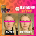 Daucus Carota K10 – limpieza desde la raíz de los granos e infecciones d ella piel luce luminosa sin excusas e hidratad@