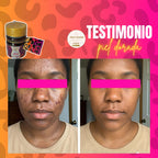 Daucus Carota K10 – limpieza desde la raíz de los granos e infecciones d ella piel luce luminosa sin excusas e hidratad@