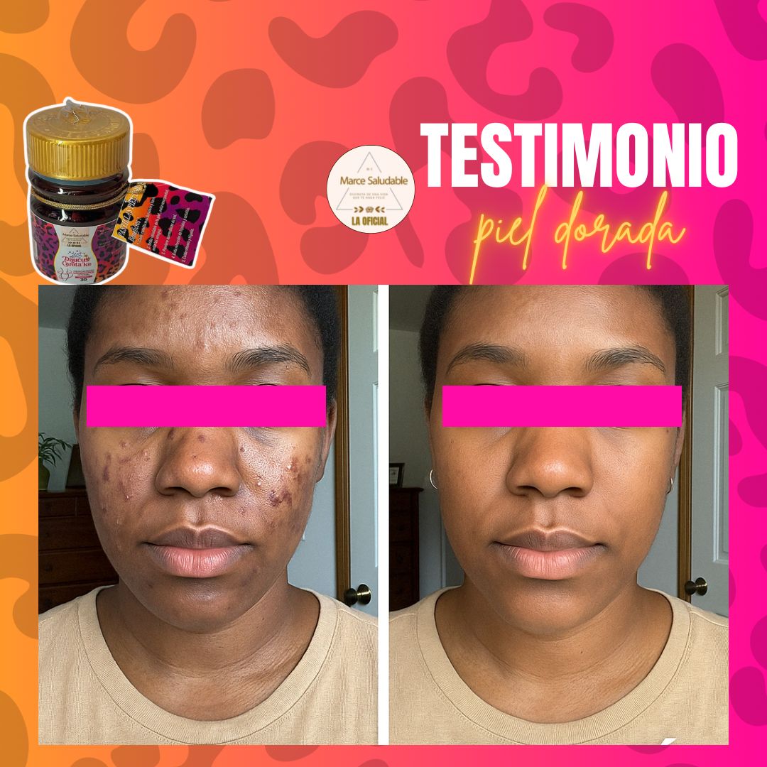 Daucus Carota K10 – limpieza desde la raíz de los granos e infecciones d ella piel luce luminosa sin excusas e hidratad@